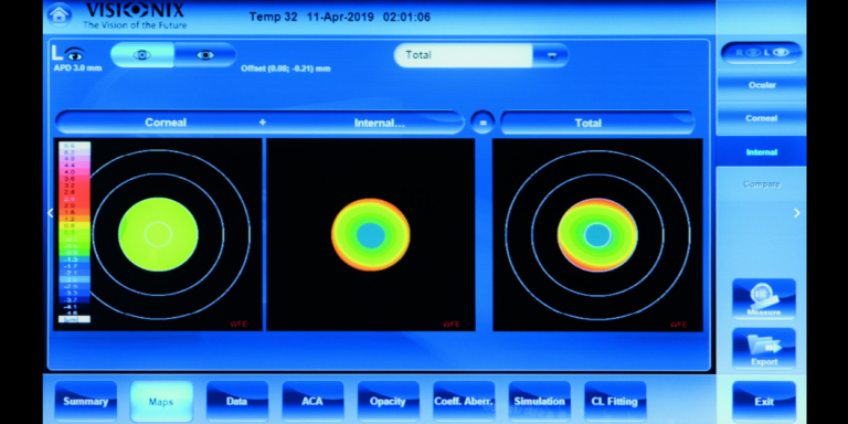Visionix | VX 130+ Allows full exam of the anterior segment