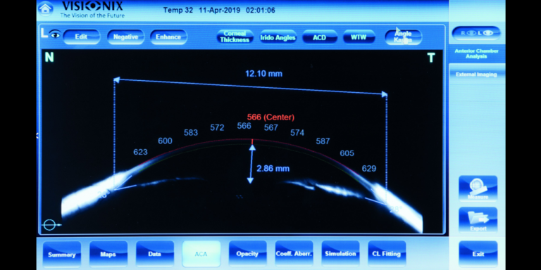 Visionix | VX 130+ Allows full exam of the anterior segment
