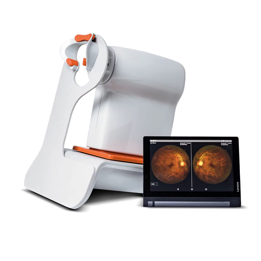 Nexy i.a allowing fundus images and retina screening